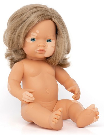 Muñeca niña caucásica rubia oscuro con vitíligo 38 cm.