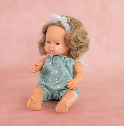 Nina amb vitiligen 38 cm MF&M